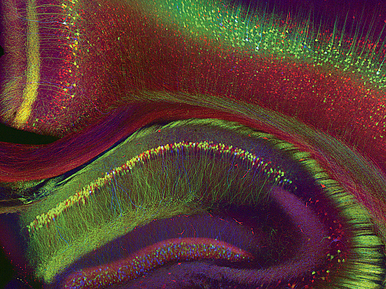 ?Weissman-Unni's image shows a mouse brain that has been genetically modified to express three different fluorescent proteins (red, yello...