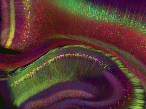 ?Weissman-Unni's image shows a mouse brain that has been genetically modified to express three different fluorescent proteins (red, yello...