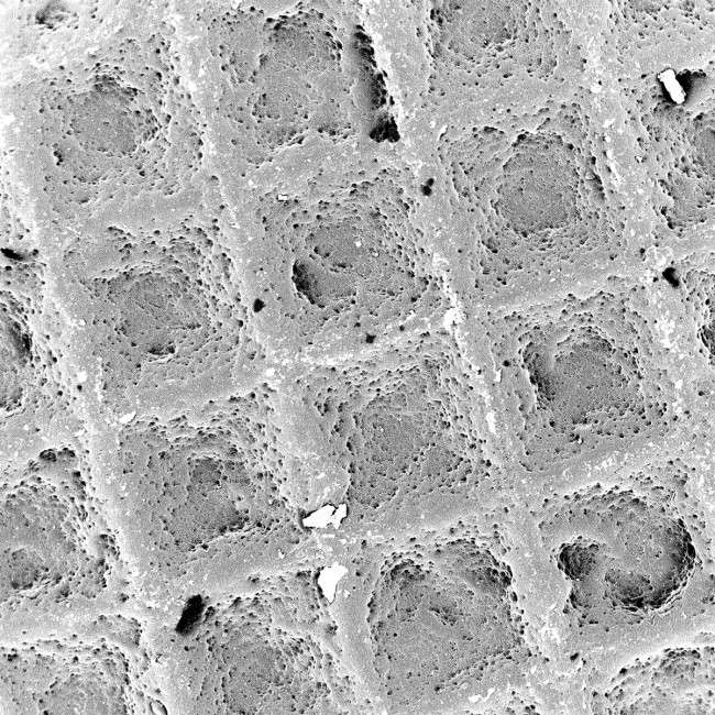 BANDAGE | This image shows the nonadhesive plastic side of a common bandage. It's made of woven polyethylene, a strong, flexible fabric t...