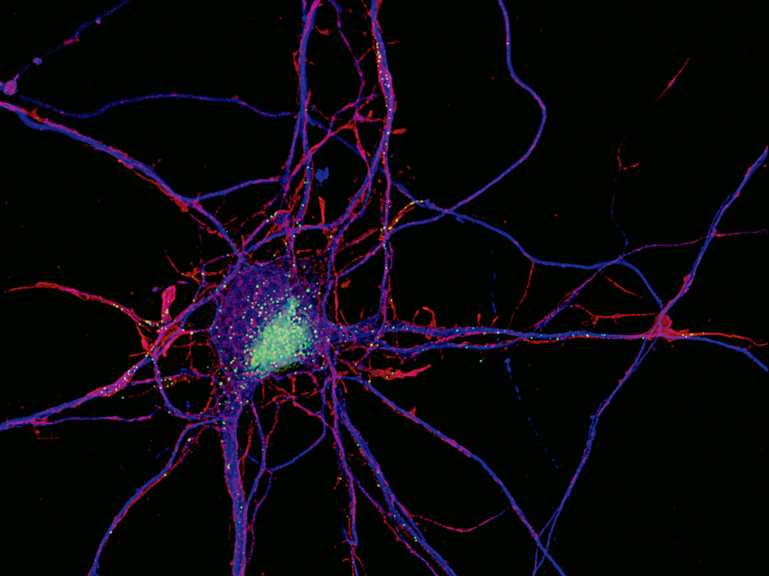 Researchers use color-coded fluorescence images, such as the one above, to visualize the nerve cells and molecules that play a key role i...
