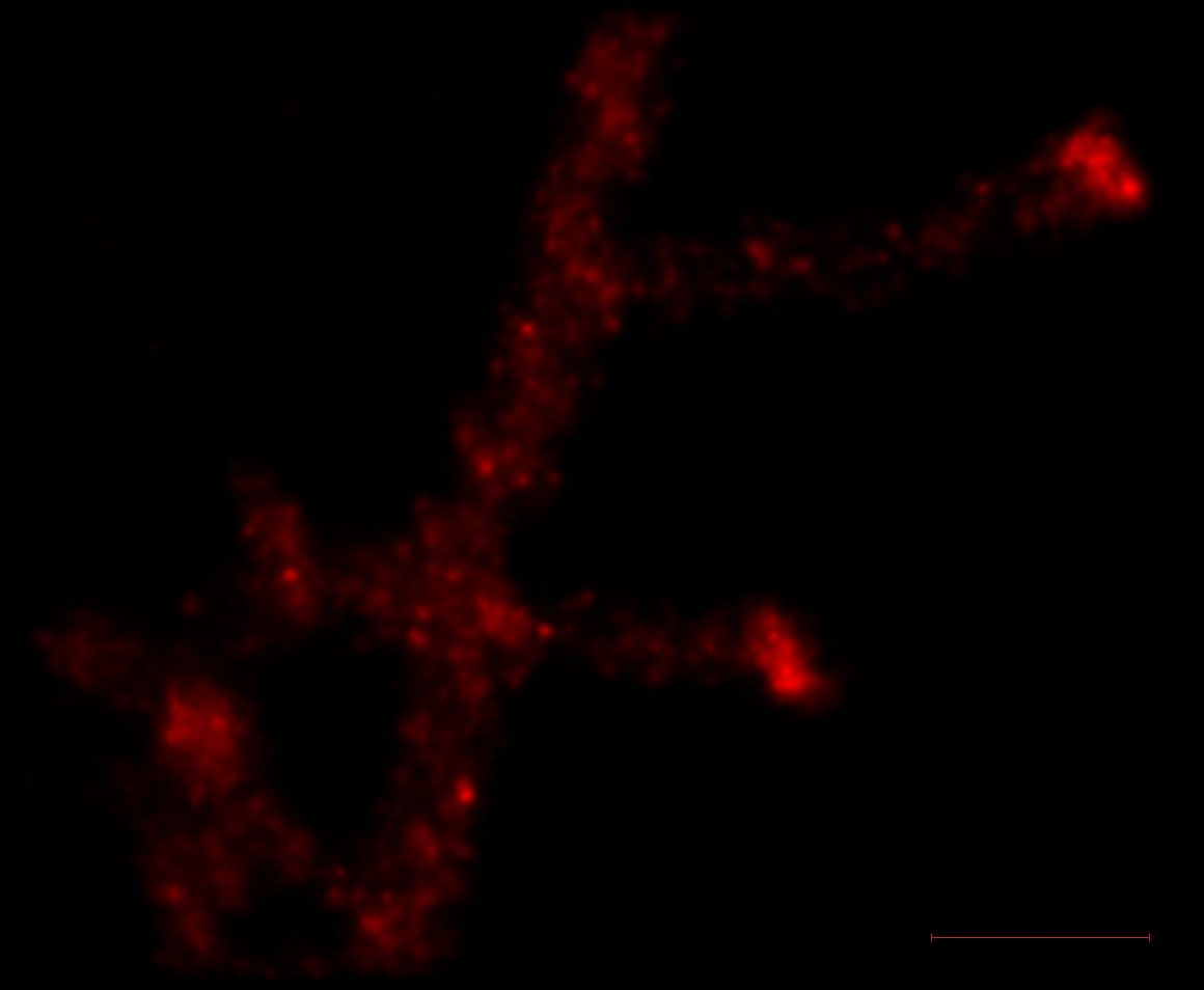 Image of a hippocampal dendrite.